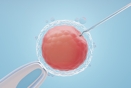 Fertility/IVF